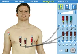 Screenshot of Virtual ECG simulation