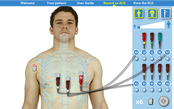 Virtual ECG: Skeleton front view