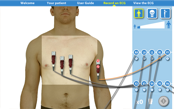 Virtual ECG: Front view restricted areas