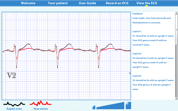 Virtual ECG: Scan result zoomed in