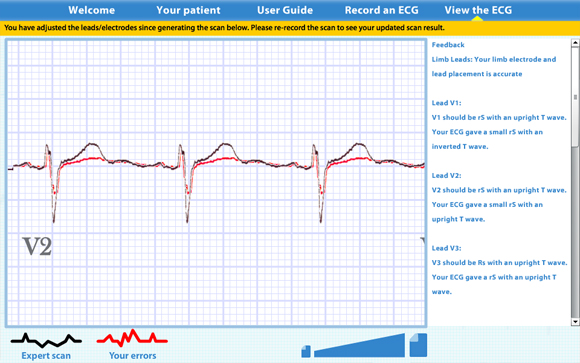 Virtual ECG: Scan result with adjustment warning