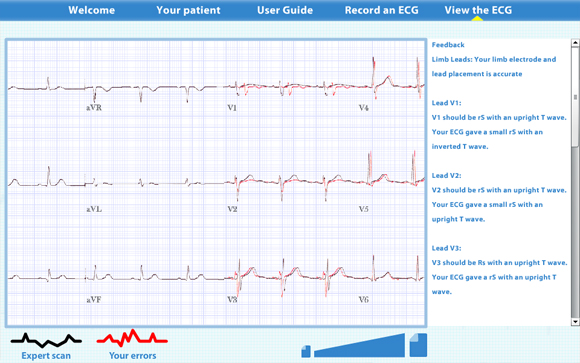 Virtual ECG: Scan result zoomed out