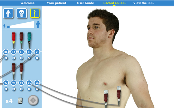Virtual ECG: Side view