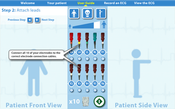 Virtual ECG: User guide